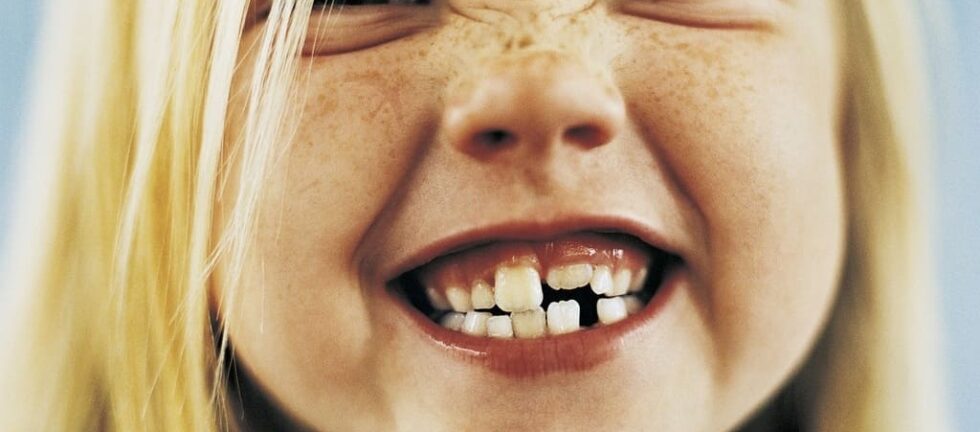 orthodontie cabinet ostéopathe enfant baillargues thomas fernandez